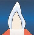 Vereinfachte Darstellung eines Zahns